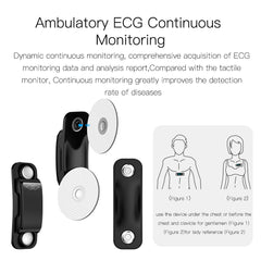 Smart Bracelet with 24-Hour ECG and Health Monitoring